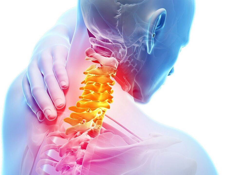 Symptomer vun der Spinal Osteochondrose