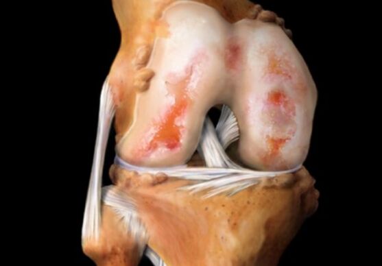 Maacht CYST