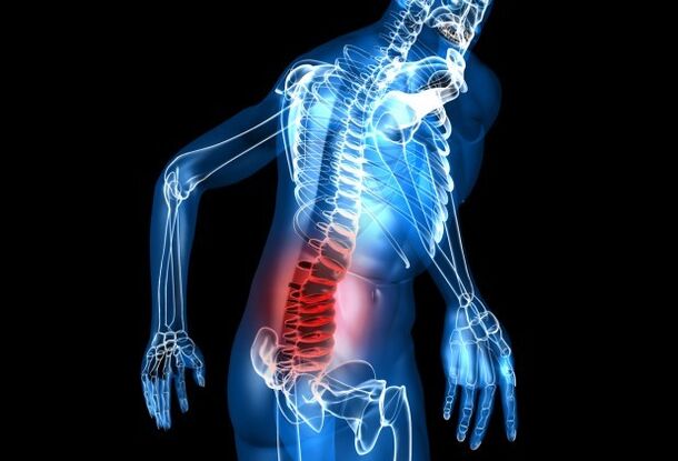 Symptomer vun Osteochondrosis