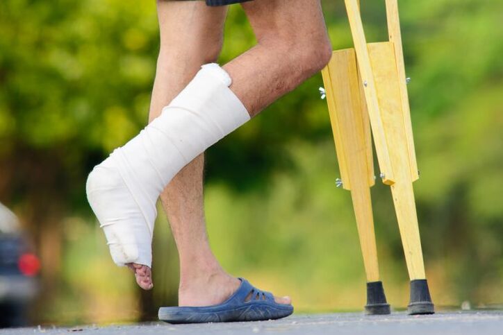 Knöchelverletzung als Ursaach vun Arthrosis