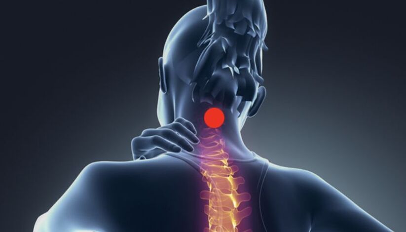 Symptomer vun cervical osteochondrosis