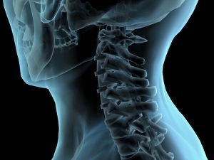 Methode fir Diagnos vun Osteochondrose vum Hals