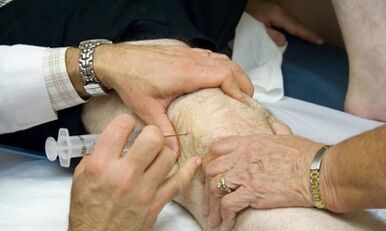 Wéi een Arthritis aus Arthrosis z'ënnerscheeden